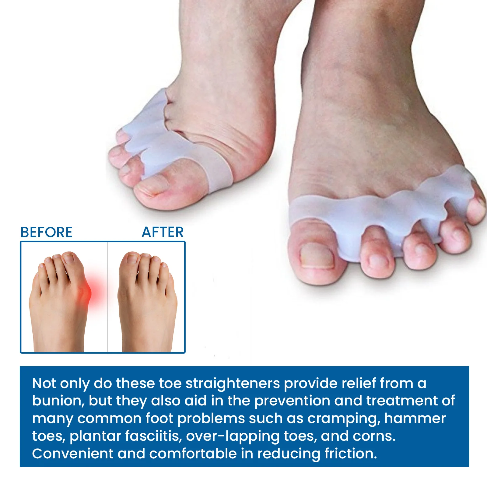 Silicone Finger Toe Protector  - Yoga Toe Separator review and price