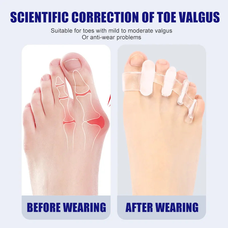 1 Pair Silicone Toe Separator  - Yoga Toe Separator review and price
