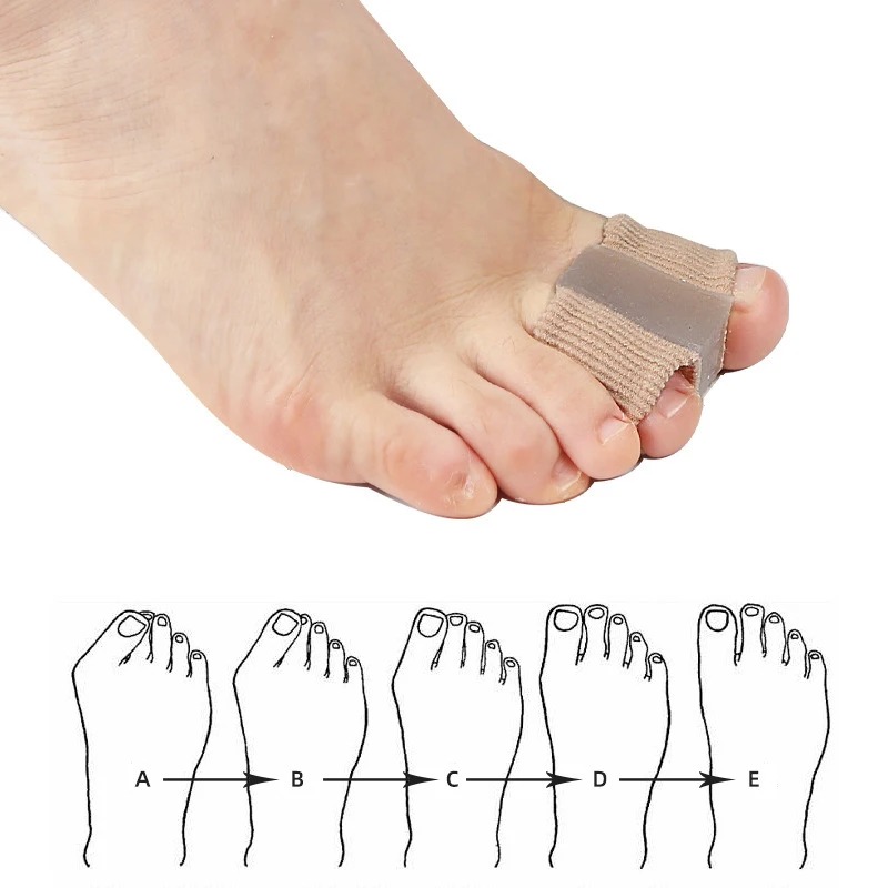 4PC Silicone Toe Separator Fin - Yoga Toe Separator review and price